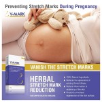 V-mark Anti Stretch Mark Cream