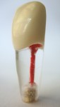 Columbia Dentoform Red Roots Endodontic Tooth - Pvr 860