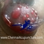 Cupping Therapy In Chennai
